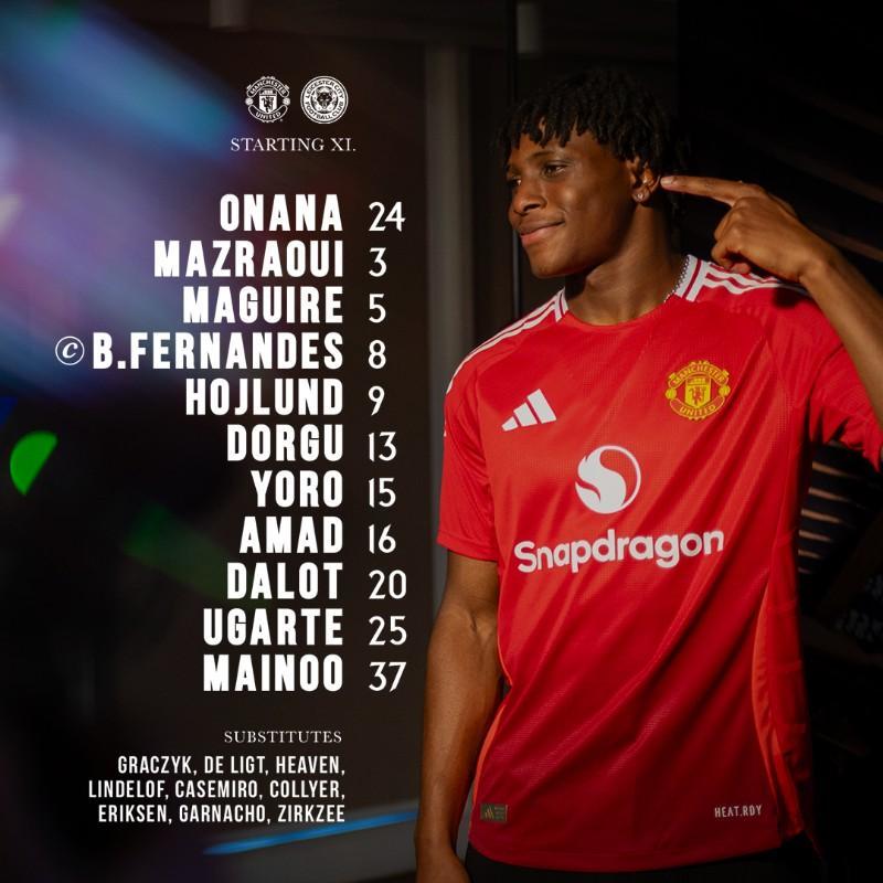 关于转折点圣安东尼奥马刺复出首秀，足总杯集结日攻防权衡，话题不断，年轻球员得到机会的信息